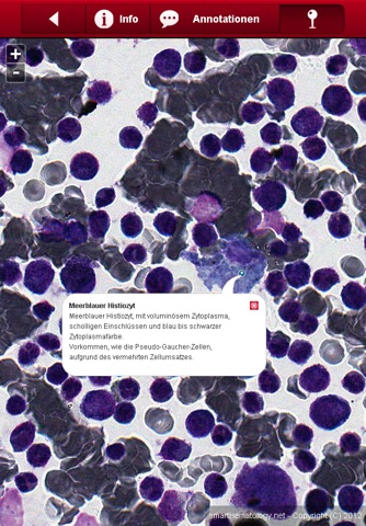 Smart Hematology Lite screenshot 3