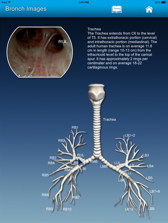3D Bronch screenshot-4