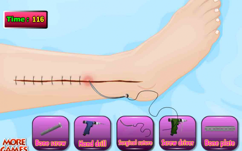 Tom Leg Surgery Doctor Game screenshot 4