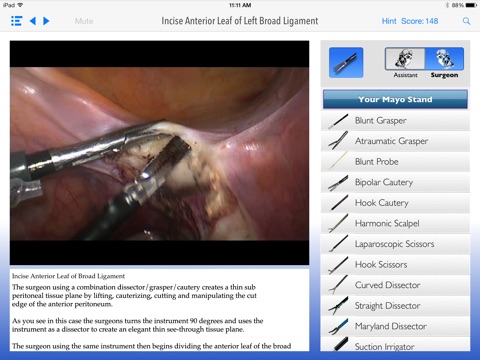 SimPraxis Lap Hysterectomy Trainer screenshot 4