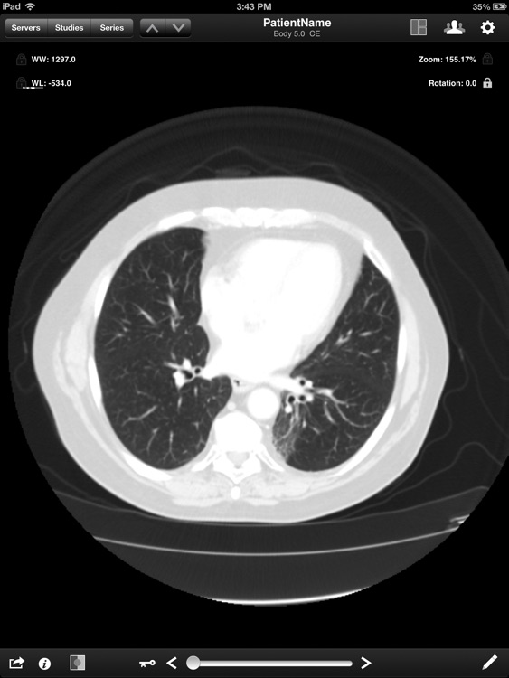 Jack Imaging Medical Image Viewer