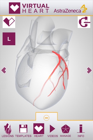 Virtual Heart - ANZ screenshot 3