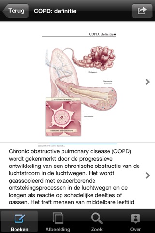 Miniatlas COPD screenshot 4