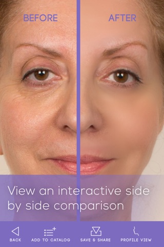FaceLift: Cosmetic Surgery Simulator + Perfect Skin + Anti-Aging Visualizer screenshot 4