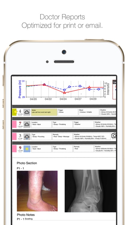 My Pain Diary: Chronic Pain & Symptom Tracker screenshot-3