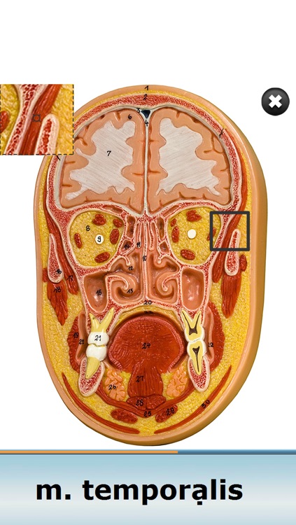 Anatomy Star - Head and Neck screenshot-3