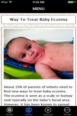 How To Treat Your Eczema - Best Way To Handle Your Eczema (Body, Face, Hand, Baby, etc.) For Beginners screenshot 3