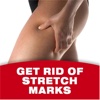 Stretch Marks 101:Essential Oils Healing,Natural Remedies and Prevention，health
