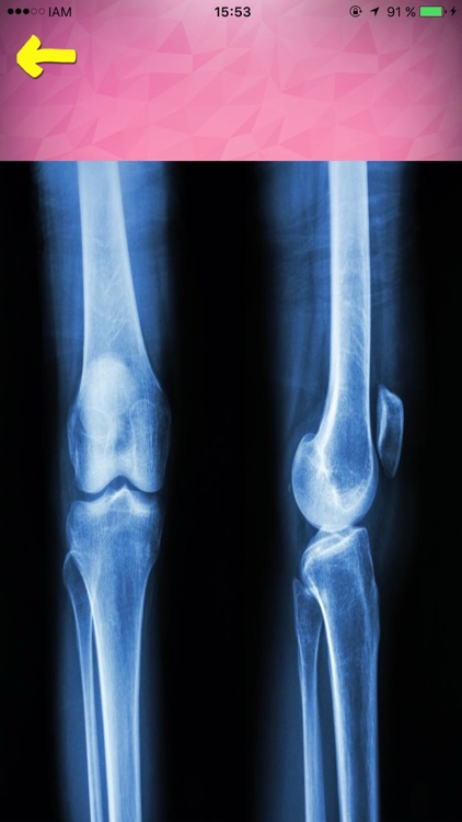 X-Ray Body Bones Scanner screenshot-4