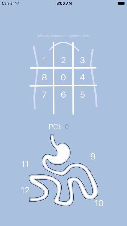 PCI - Peritoneal Carcinomatosis Index