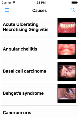 Key to the Diagnosis of Oral Ulceration screenshot 4
