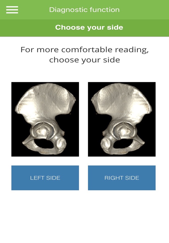 Acetabular Fractures screenshot 3