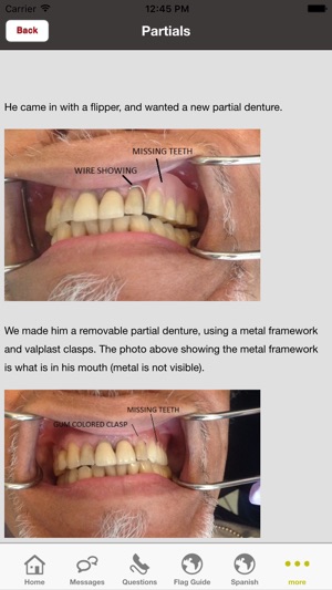 Dental Translation(圖4)-速報App