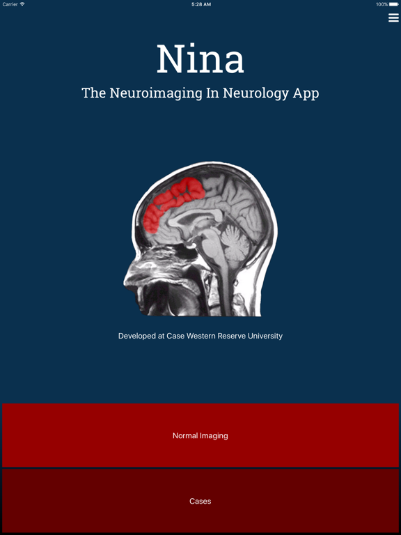 Screenshot #4 pour Nina Neuroimaging in Neurology