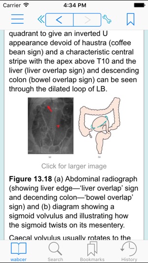 ABC of Emergency Radiology, 3rd Edition(圖3)-速報App