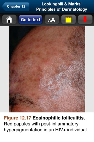 Lookingbill & Marks' Derm. 5E screenshot 3