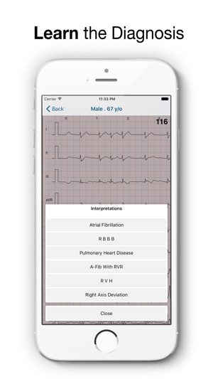 ECG Quiz Pro(圖4)-速報App