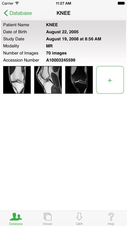 OsiriX HD screenshot-3