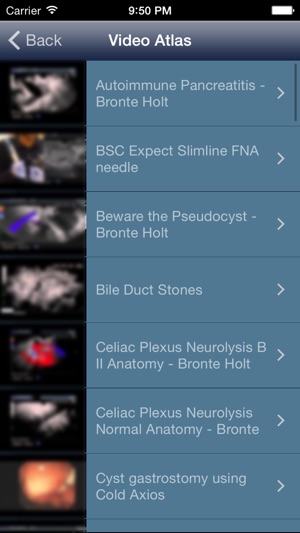 EUS - Diagnostic and Interventional Endoscopic Ultrasound(圖4)-速報App