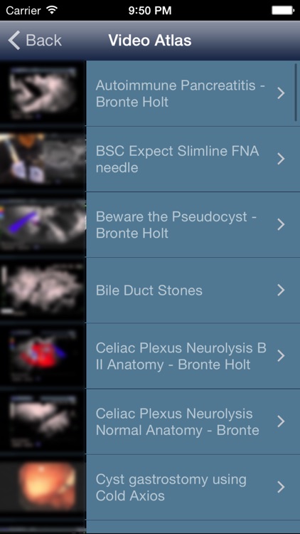 EUS - Diagnostic and Interventional Endoscopic Ultrasound screenshot-3