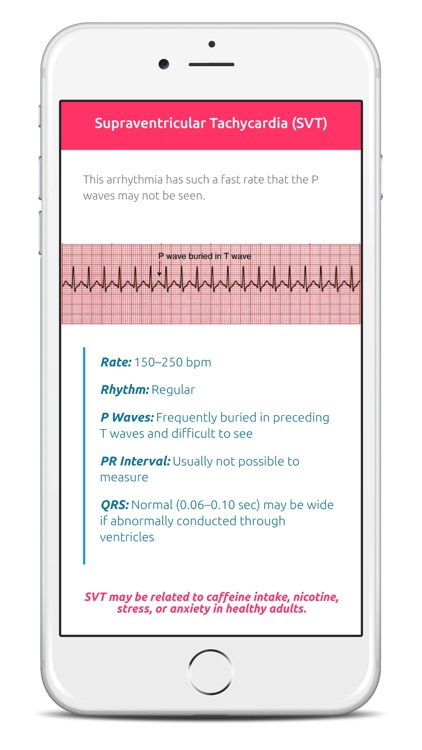 ECG FlashCards Pro