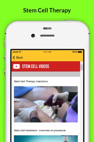 Stem Cell Therapy - Anti aging Treatment screenshot 4