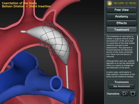 3D Road Map to Congenital Heart Disease screenshot 2