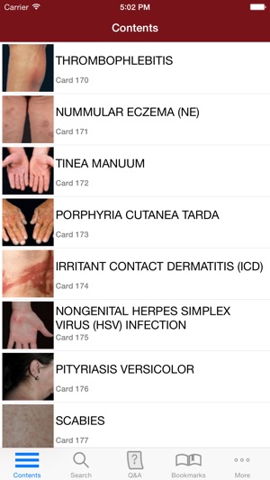 Fitzpatrick's Derm Flash Cards(圖2)-速報App