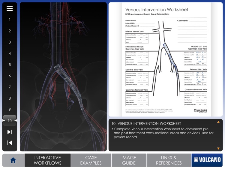 Venous IVUS screenshot-3