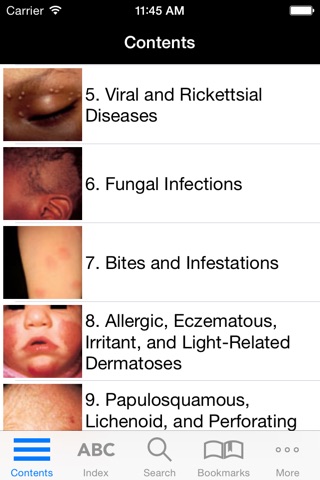 Atlas of Pediatric Dermatology screenshot 2