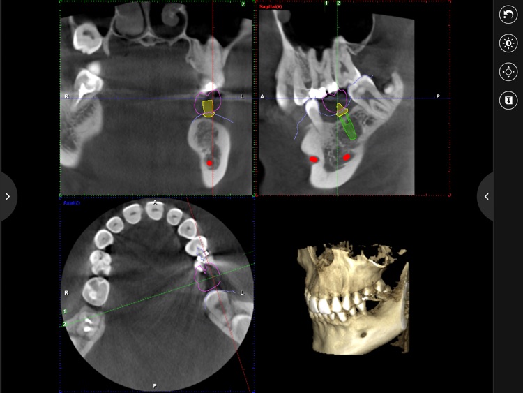 Planmeca mRomexis screenshot-3