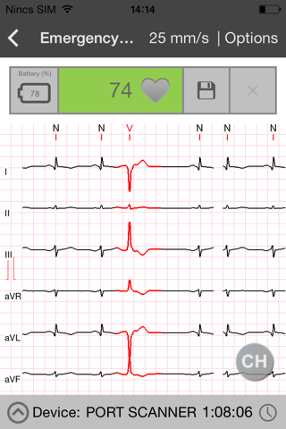 Cardiospy Mobile ECG screenshot 3