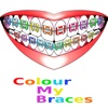 Colour My Braces