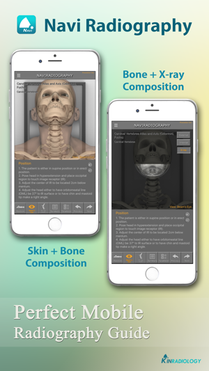 Navi Radiography Lite(圖3)-速報App