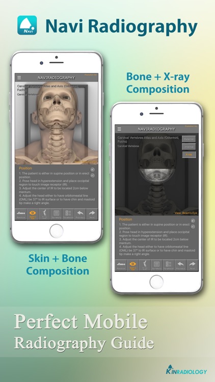 Navi Radiography Lite