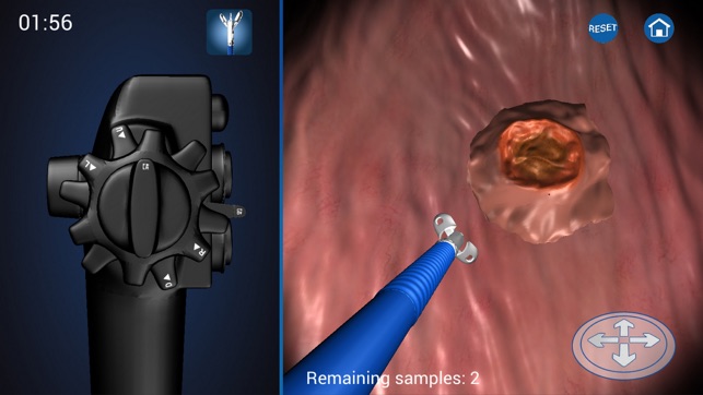 Endoscopy 3D(圖4)-速報App