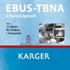 EBUS-TBNA: A Practical Approach