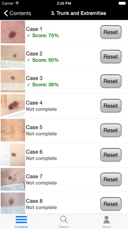 Dermoscopy: An Illustrated Self-Assessment Guide screenshot-4