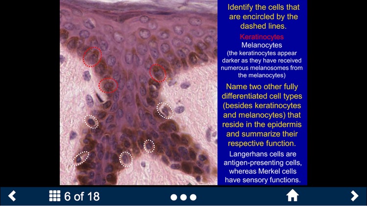 Histology - Musculoskeletal System screenshot-4