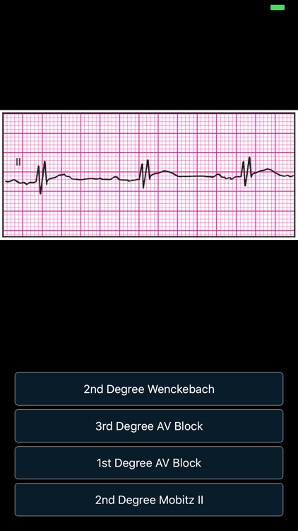 ECG - Cases for CME & EMT screenshot-8