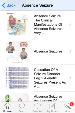 1000 Neurology Medical Dictionary - náhled