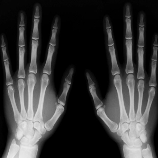 Radiography Glossary and Flashcard,Study Guide