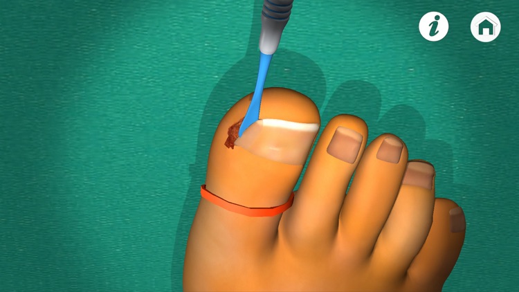 Podiatry 3D screenshot-3
