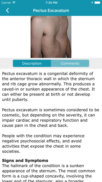Pectus Clinic. screenshot 2