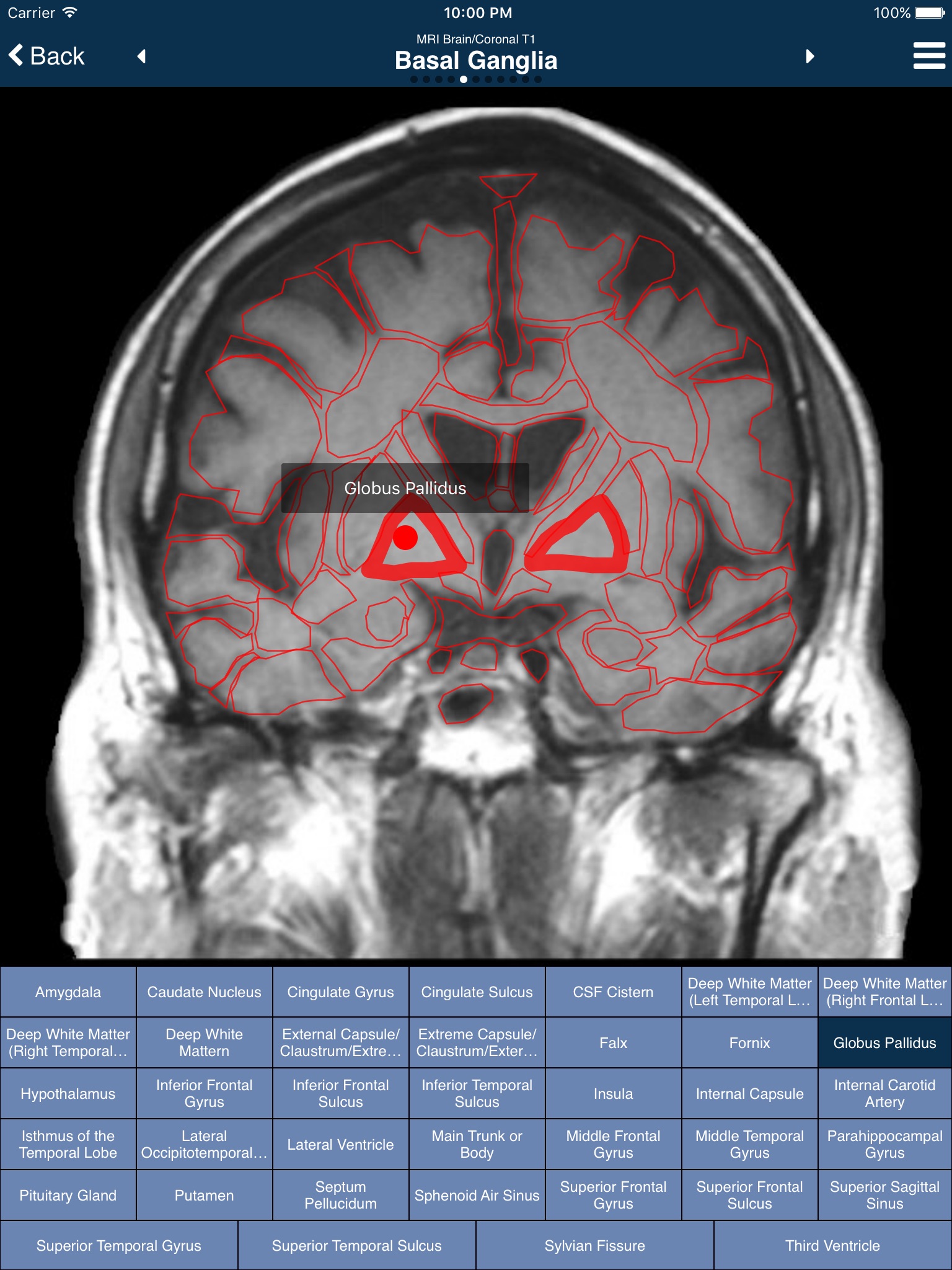 Nina Neuroimaging in Neurology screenshot 4