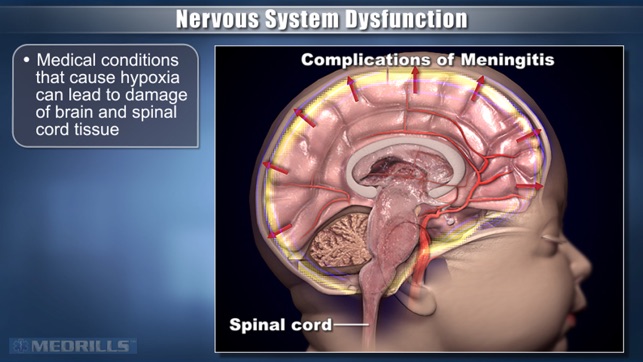 Medrills: Pathophysiology