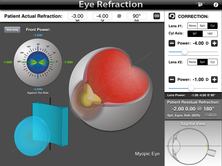 Eye Refraction