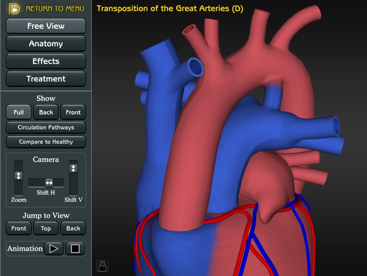 3D Road Map to Congenital Heart Disease screenshot-3