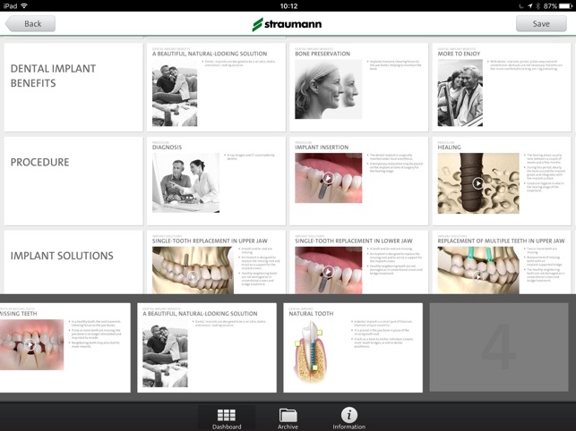 Straumann® Patient Education App(圖4)-速報App