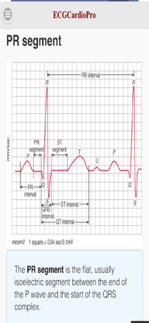 ECGCardio(圖4)-速報App